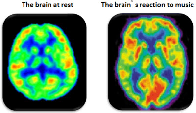 Brain at rest and Brain listening to music.